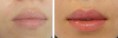 /album/l%c3%a8vres/maquillage-permanent-l%c3%a8vres-institut-sigma-5a-jpg/